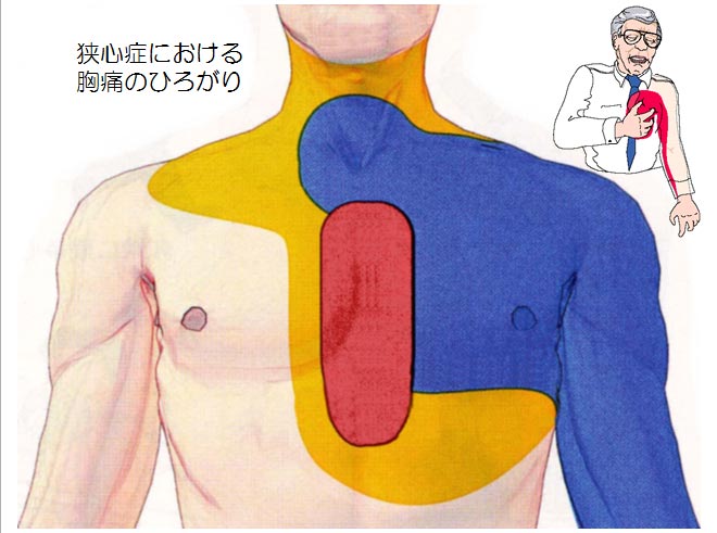 真ん中 痛い 胸 が 「胸の真ん中が痛い」その症状は病気のサインかも！？